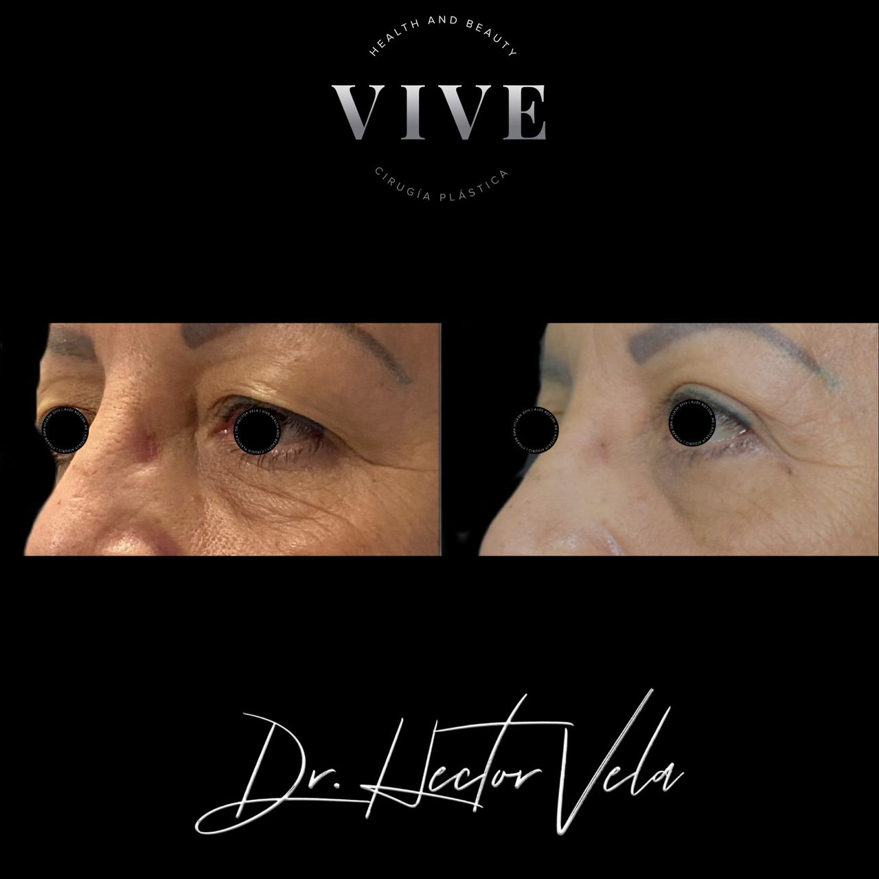 Héctor Eduardo Vela Cardona-169