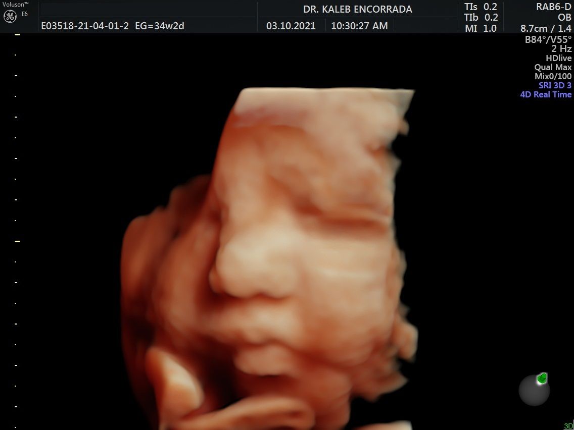 Hugo Kaleb Encorrada Luarca-22