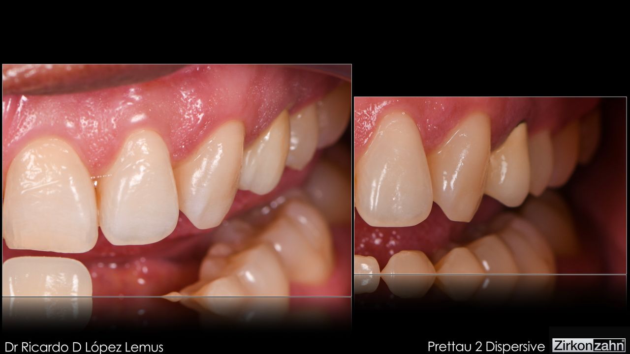 Ricardo López Lemus-62