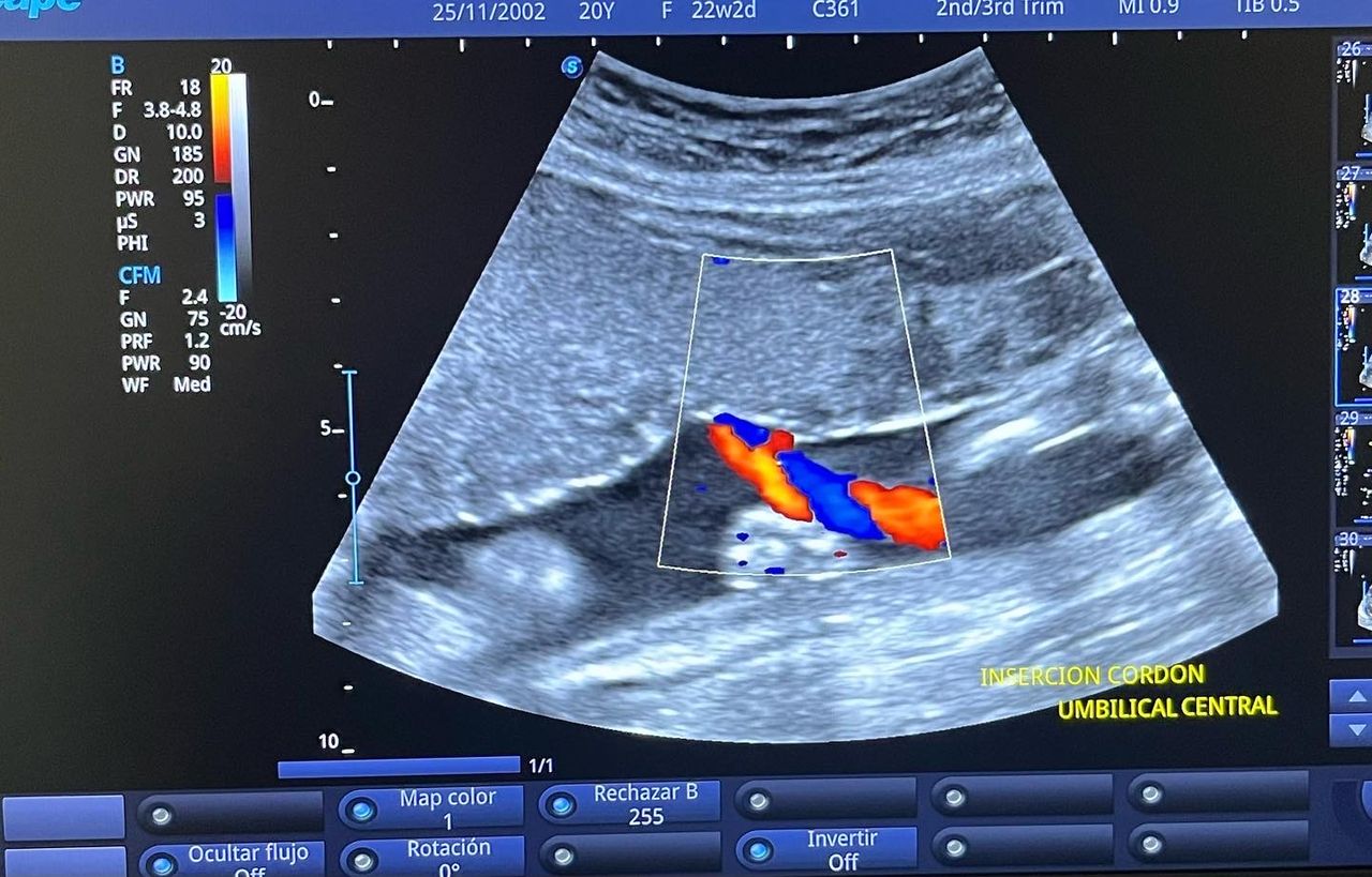 César Guerra Martínez-43