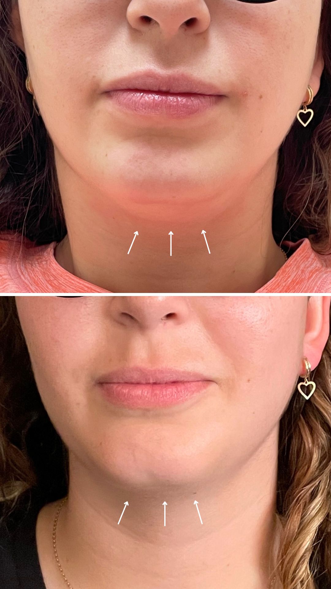 Alejandra Gutierrez García-30