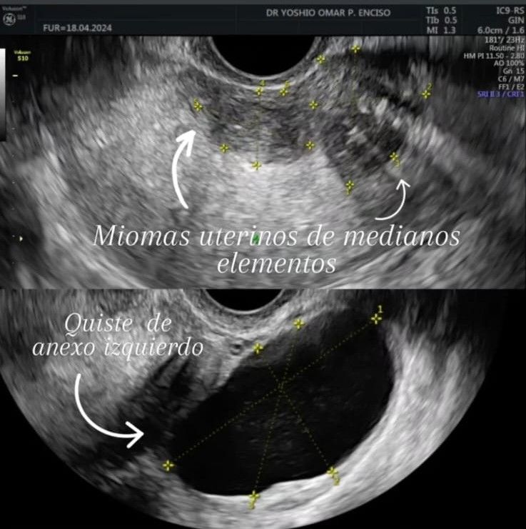 Yoshio Omar Payan Enciso-3