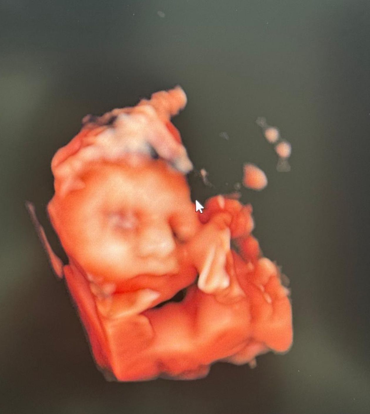 Carlos Ulises Romero Zarate-5