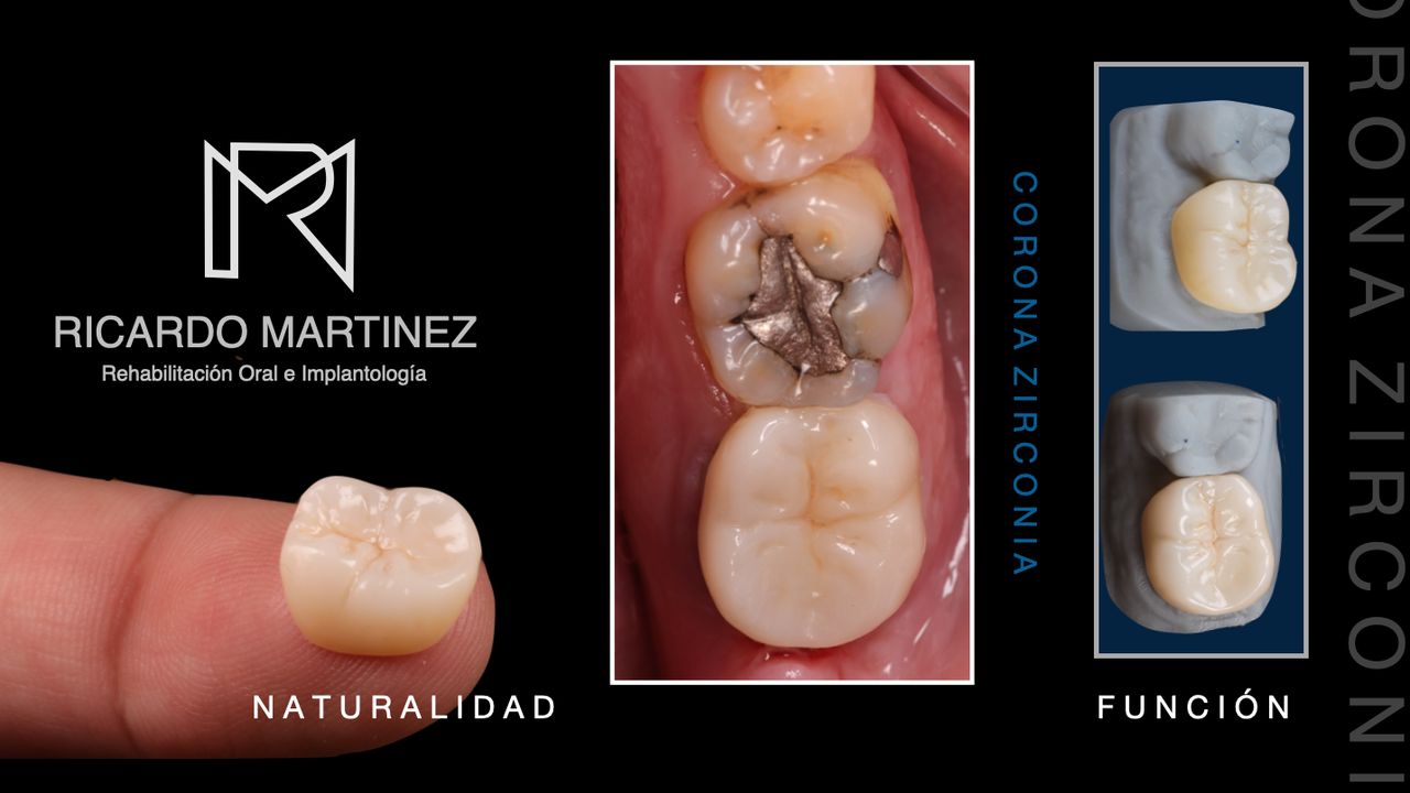 J. Ricardo Martínez-10