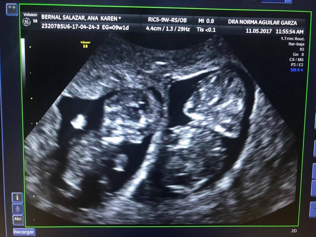 Norma Aguilar Garza-10