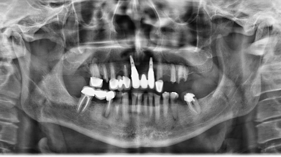 Georgina Zurita Rdz-0