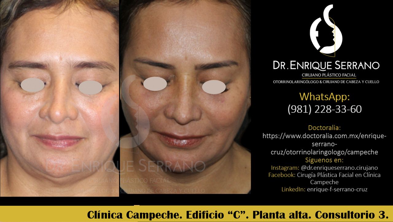 Enrique Serrano Cruz-58