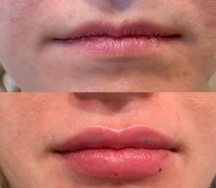 Balbina San Lorenzo Diaz-5