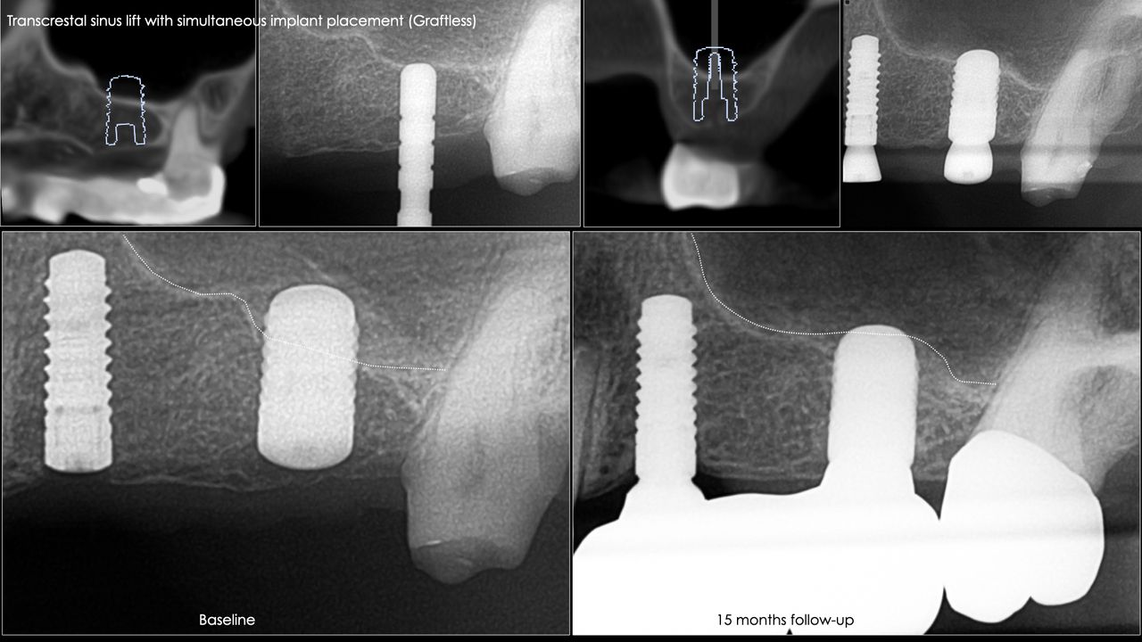 Ricardo López Lemus-108