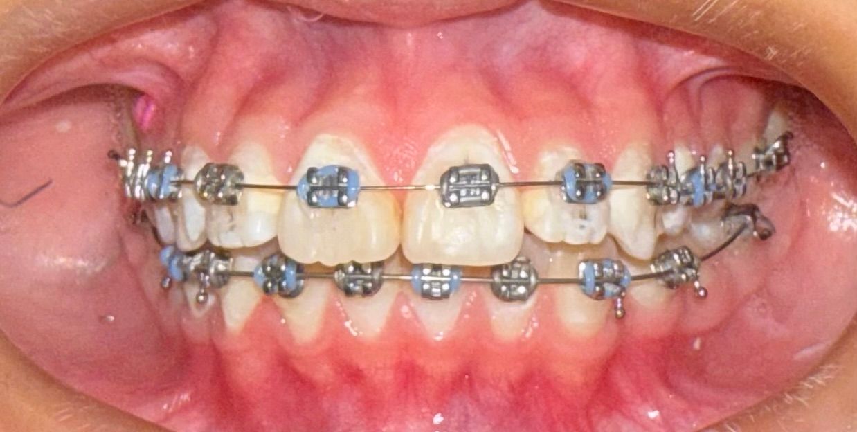 Zoe Guadalupe  Hernandez Aguilar-1