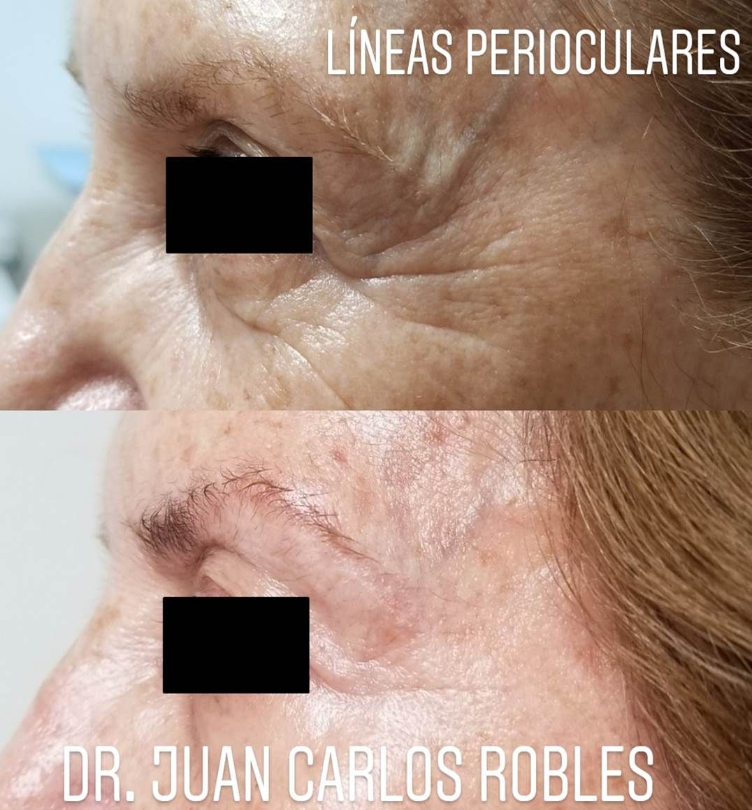 Juan Carlos Robles Méndez-32