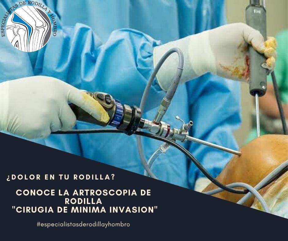 Cristopher Jonathan Montalvo Díaz-6