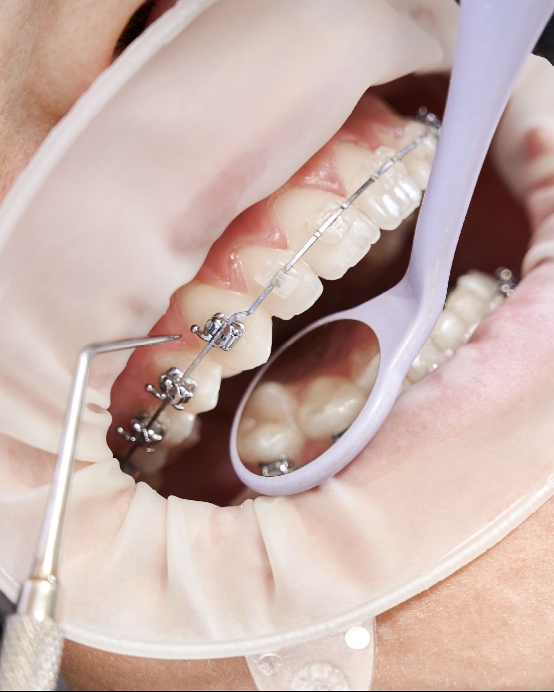 Diana De La Torre Priego-53