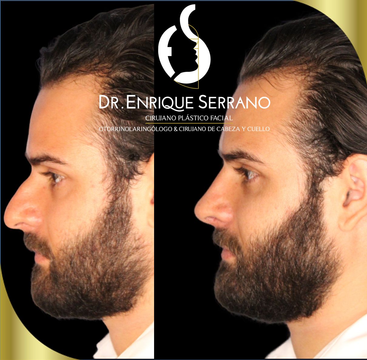 Enrique Serrano Cruz-4