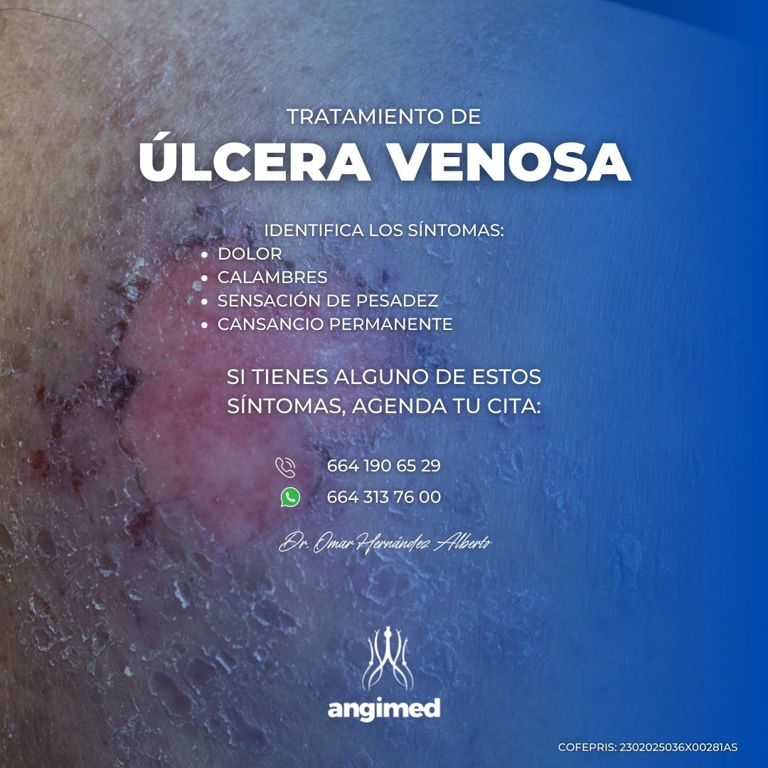 Omar Hernández Alberto-5