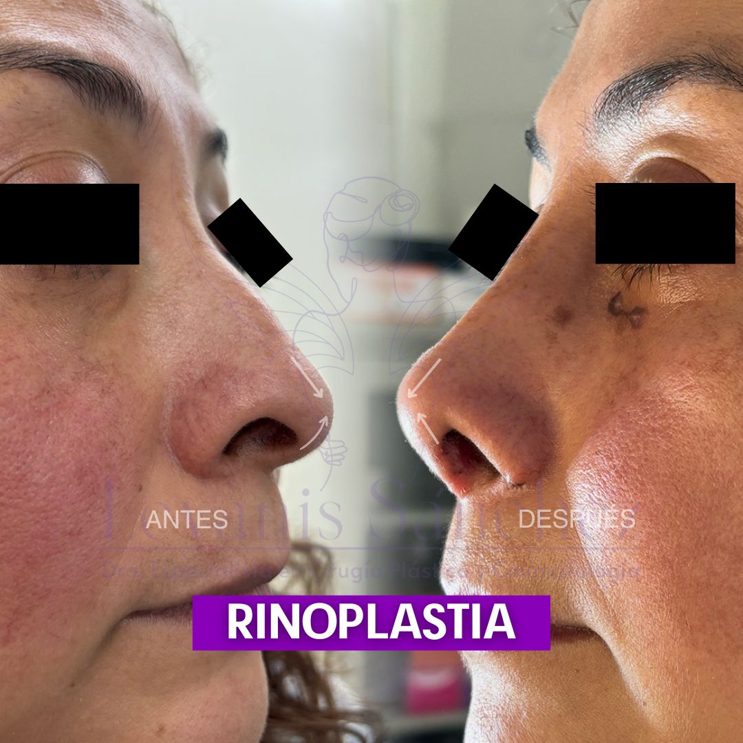 Leyanis Sánchez Hidalgo-8