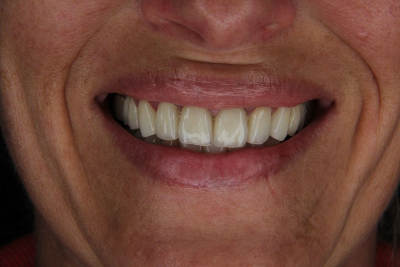 Arturo Mendez Valencia-15