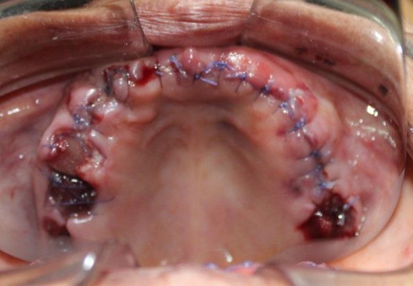 Juan Manuel Méndez Ferrusco-11