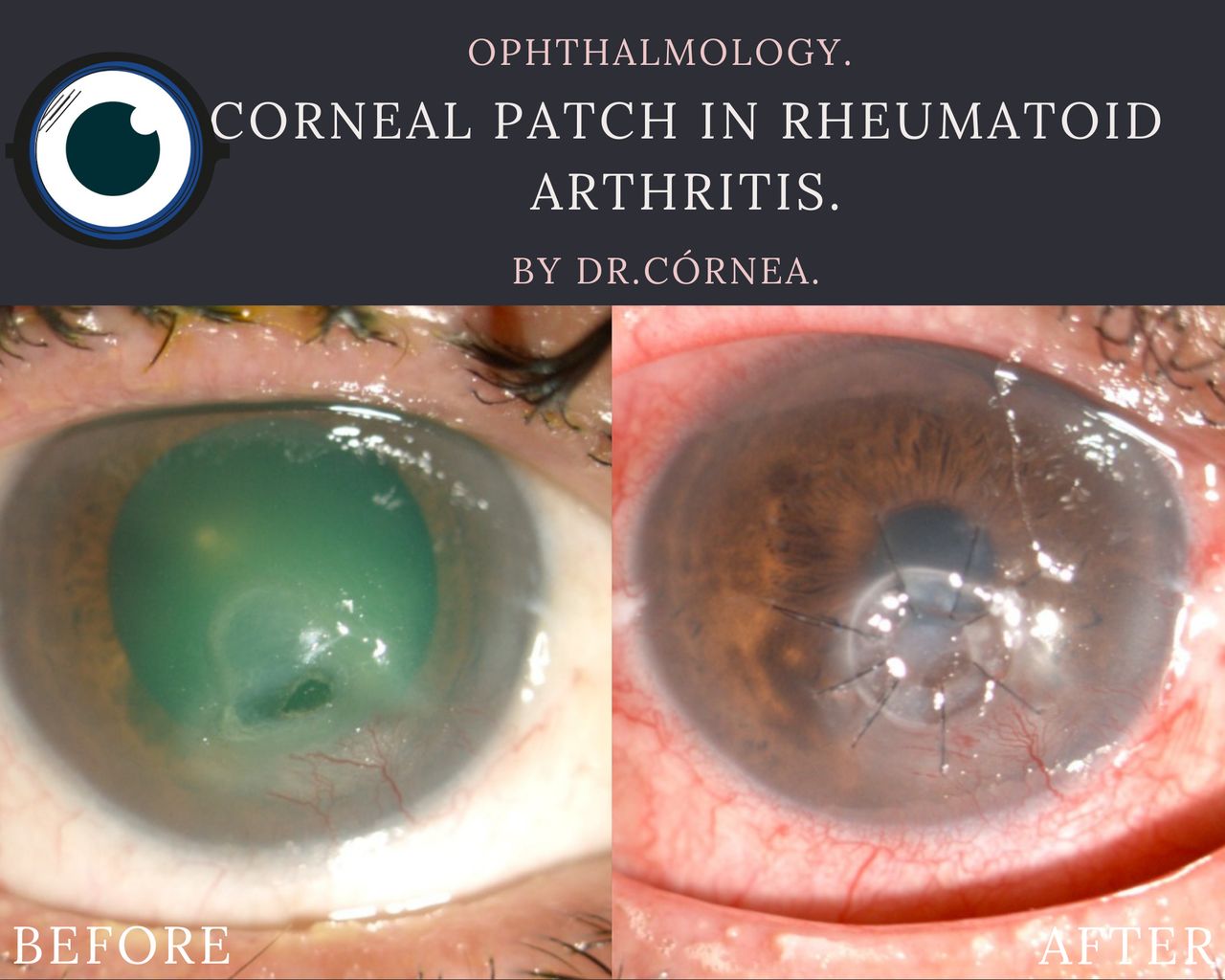 Kristian Alfonso Vazquez Romo-35