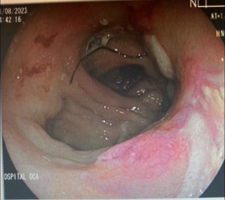 J. César Reyes Vásquez-24