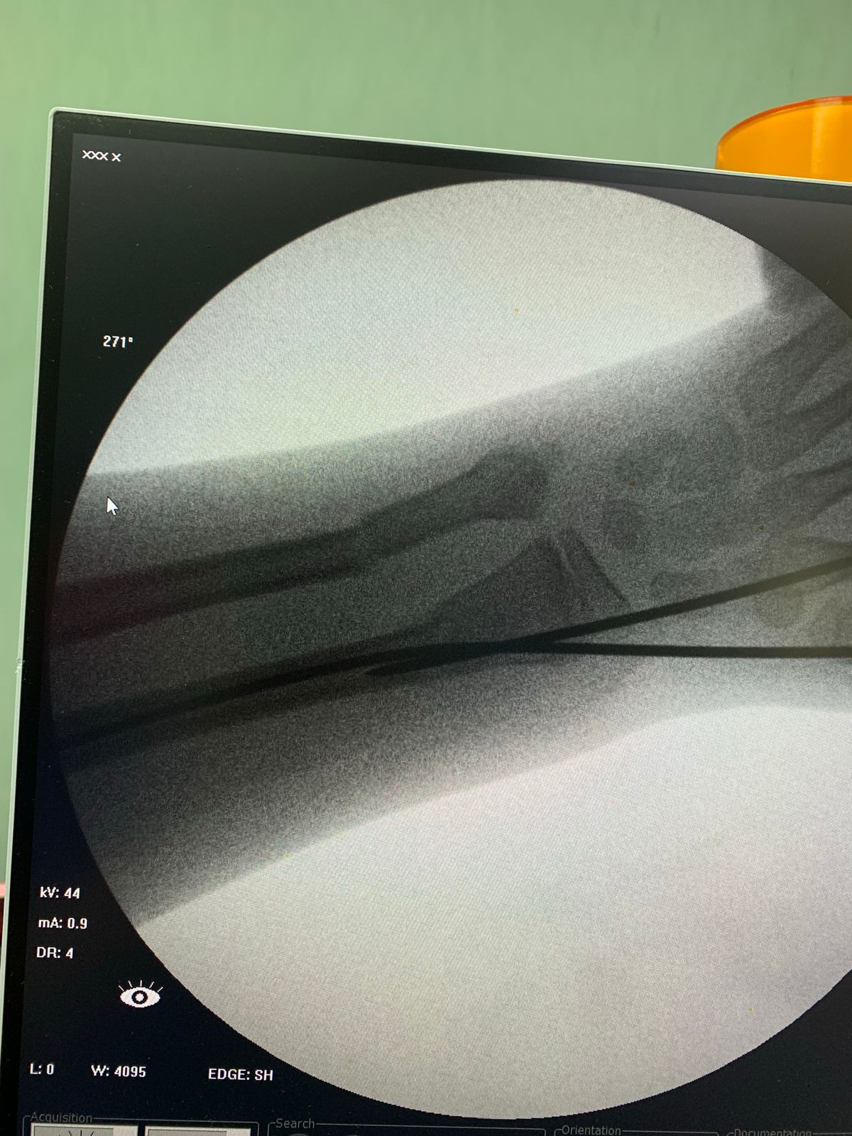 Christian G. García García-38