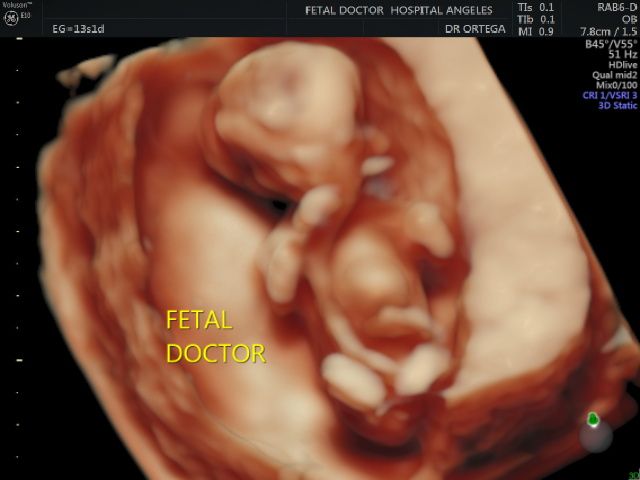 Jesús Manuel Ortega Flores-15