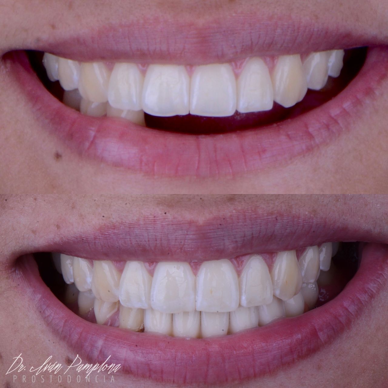 Iván Gerardo Pamplona Alfaro-22