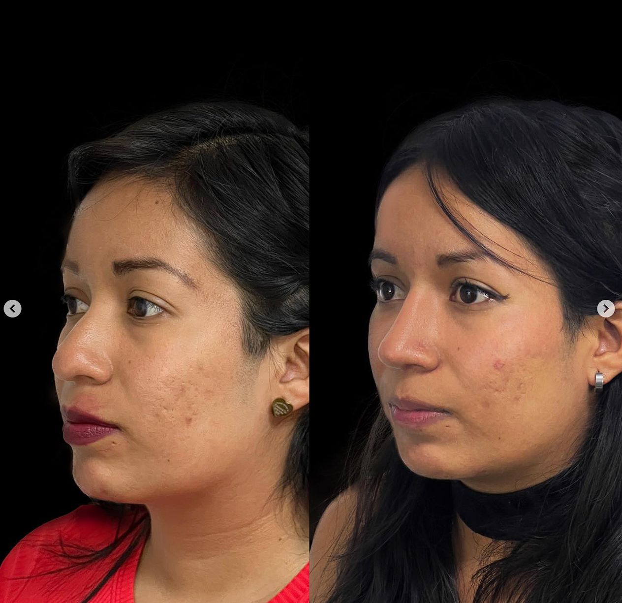 Carlos Alfonso Romero Gameros-20