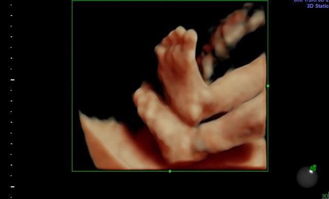 Elizabeth Valdez Lara-8