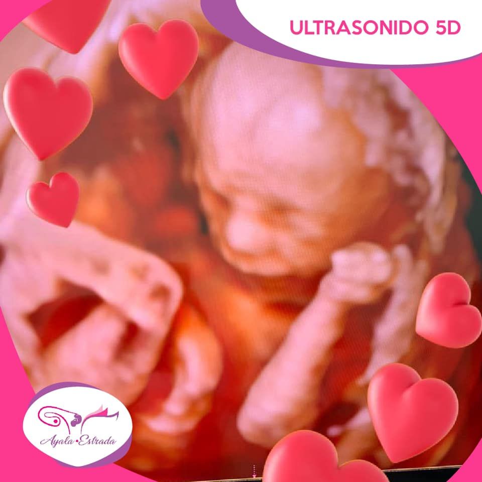 María Elena Estrada Ruiz-4