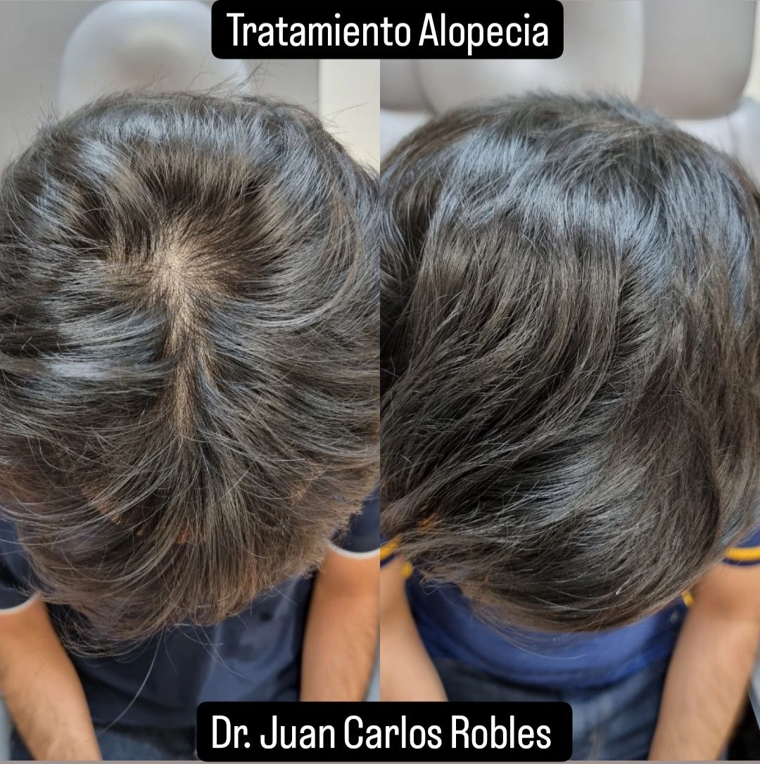 Juan Carlos Robles Méndez-6