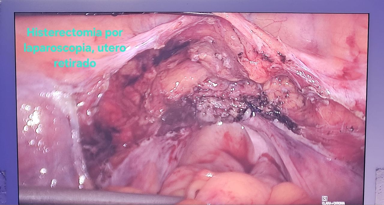 Jorge Alberto Rodriguez Pezino-42