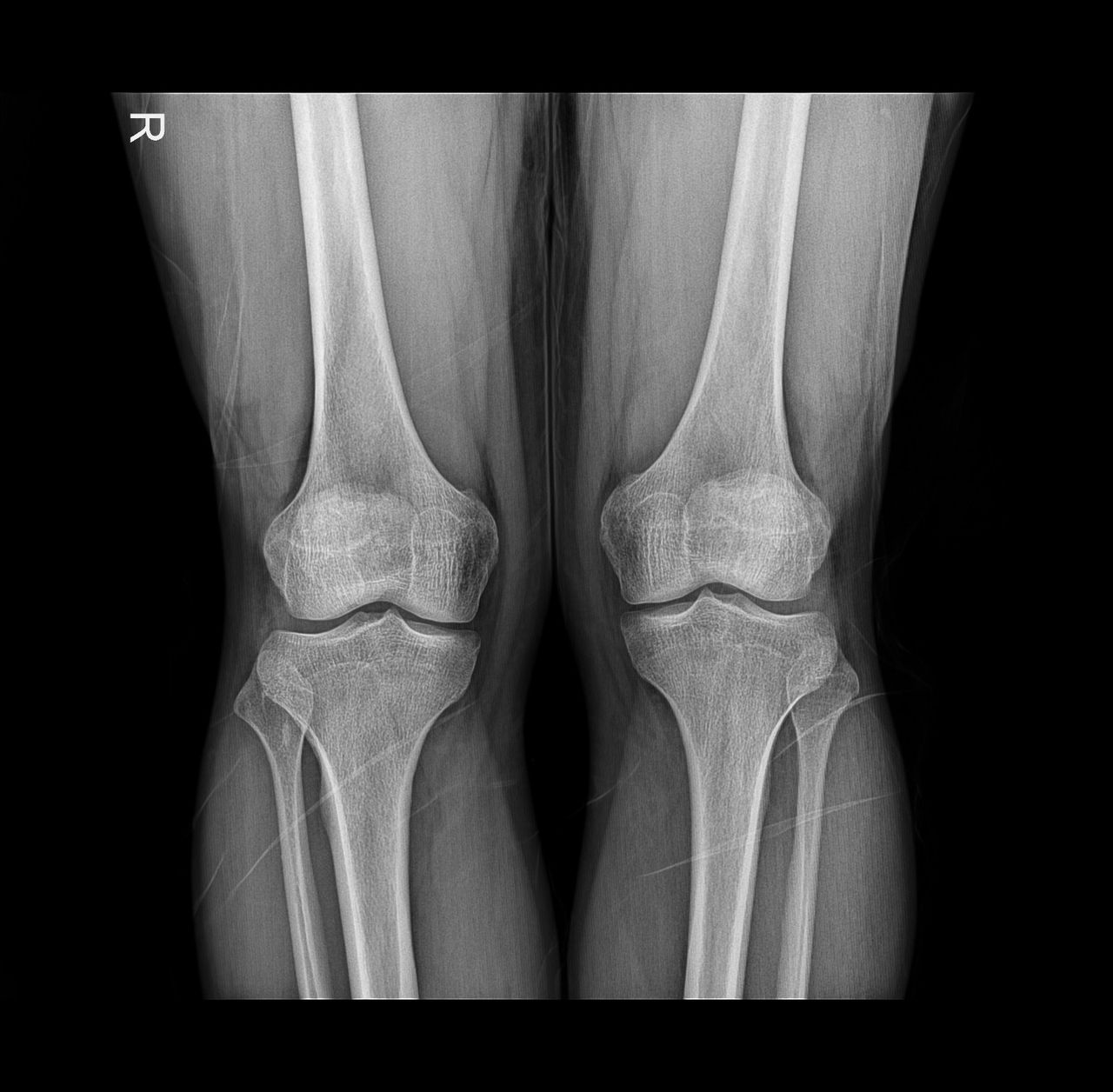 Lizeth Patricia Mena Rivas-42