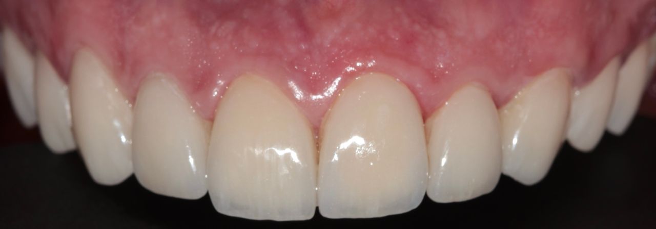 Emmanuel Pineda Herrera-3