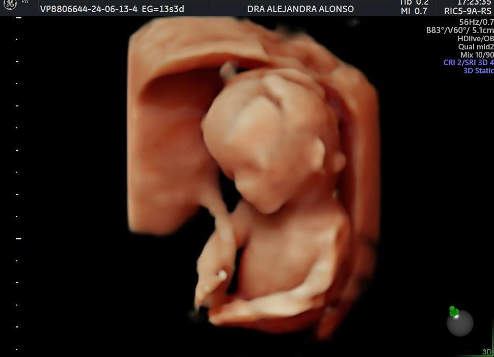 Alejandra Alonso Martínez-4