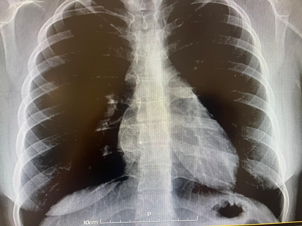 Alba Melina Ascañio Flores-6