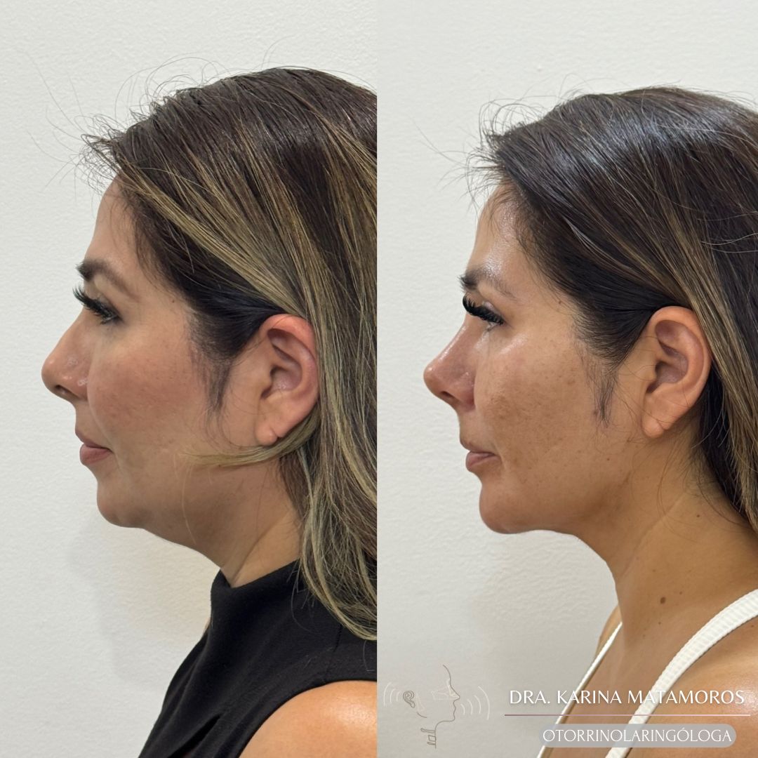 Ana Karina Matamoros Conejo-4