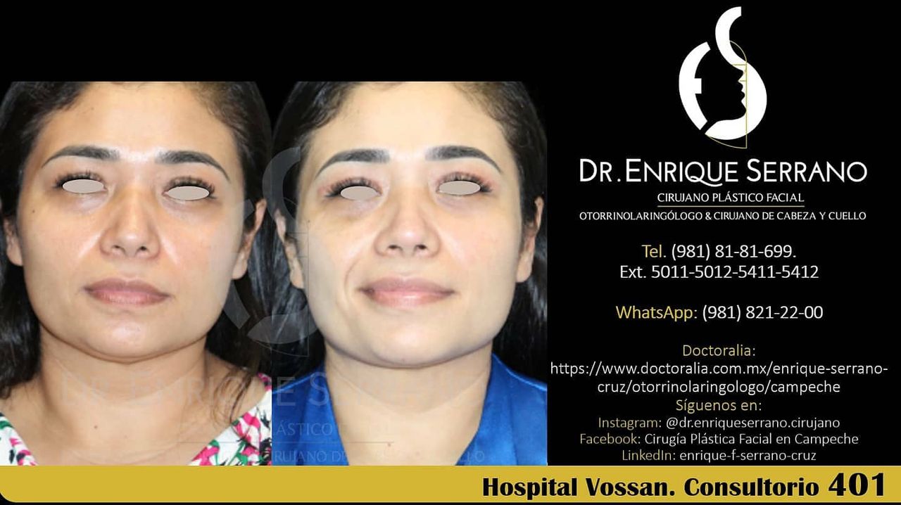 Enrique Serrano Cruz-105