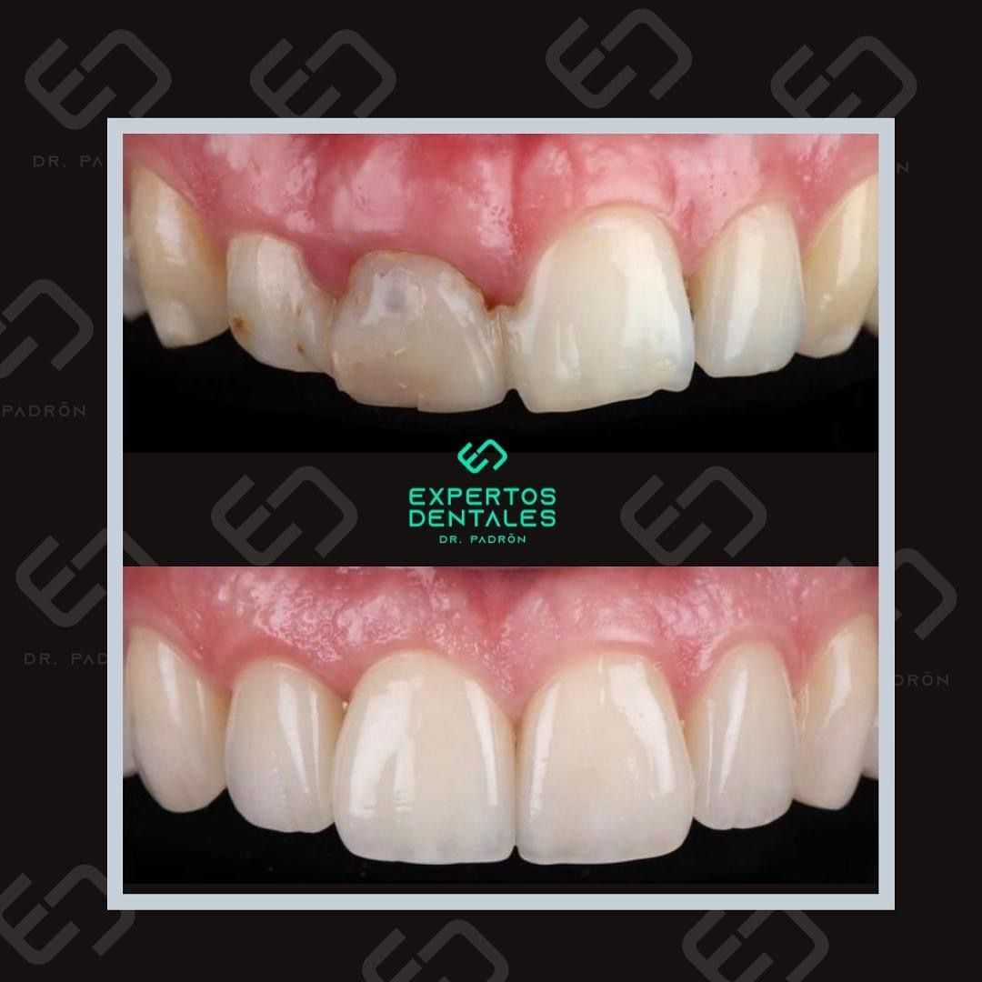 Gerardo Padrón Lagunes-12