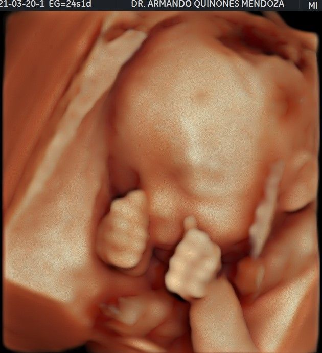 Armando Quiñones Mendoza-3