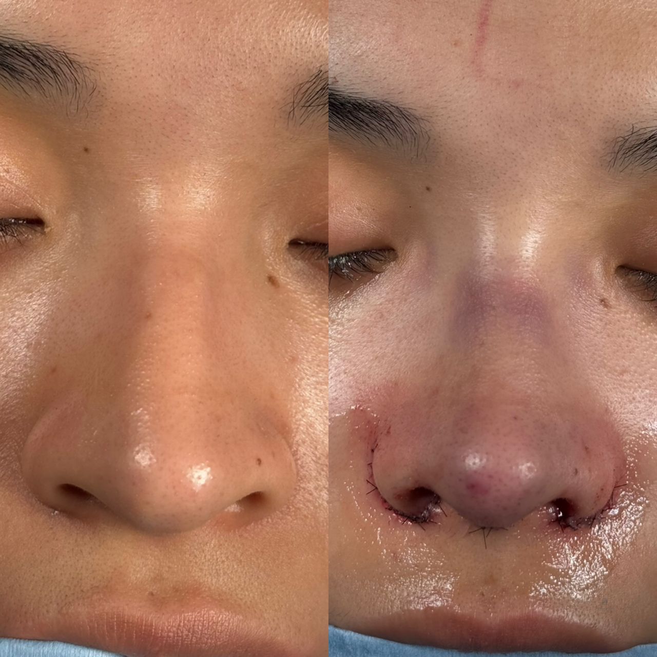 Angel Castro Urquizo-228