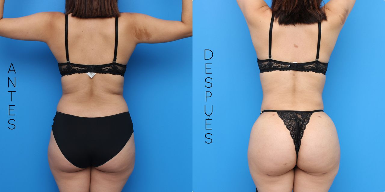 Bernardo Vargas-10