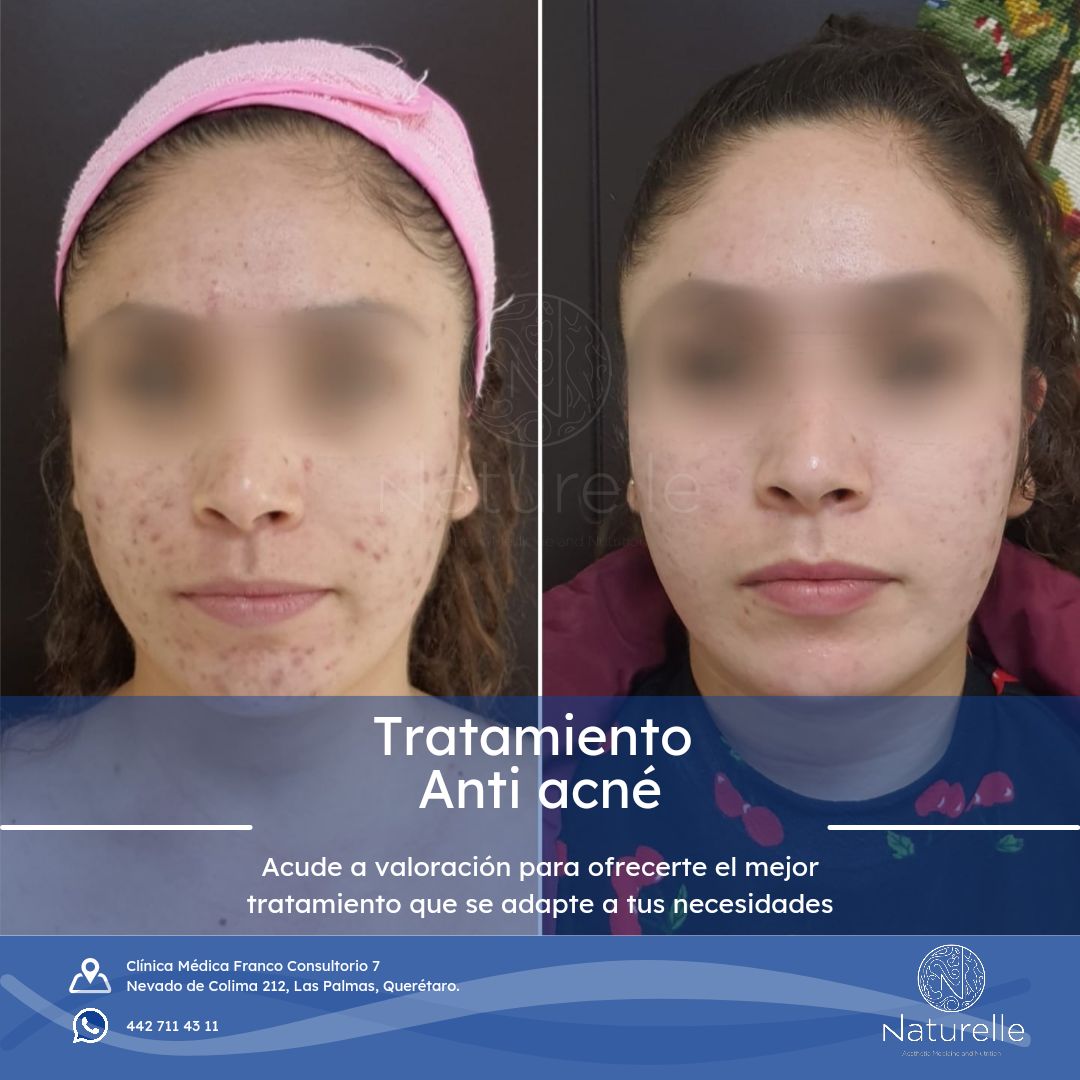 Daniel Marín Jasso-29