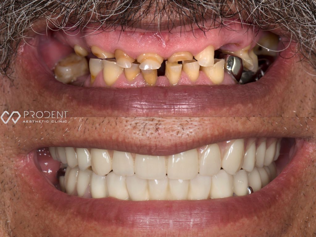 Ulises Pérez Murillo-37