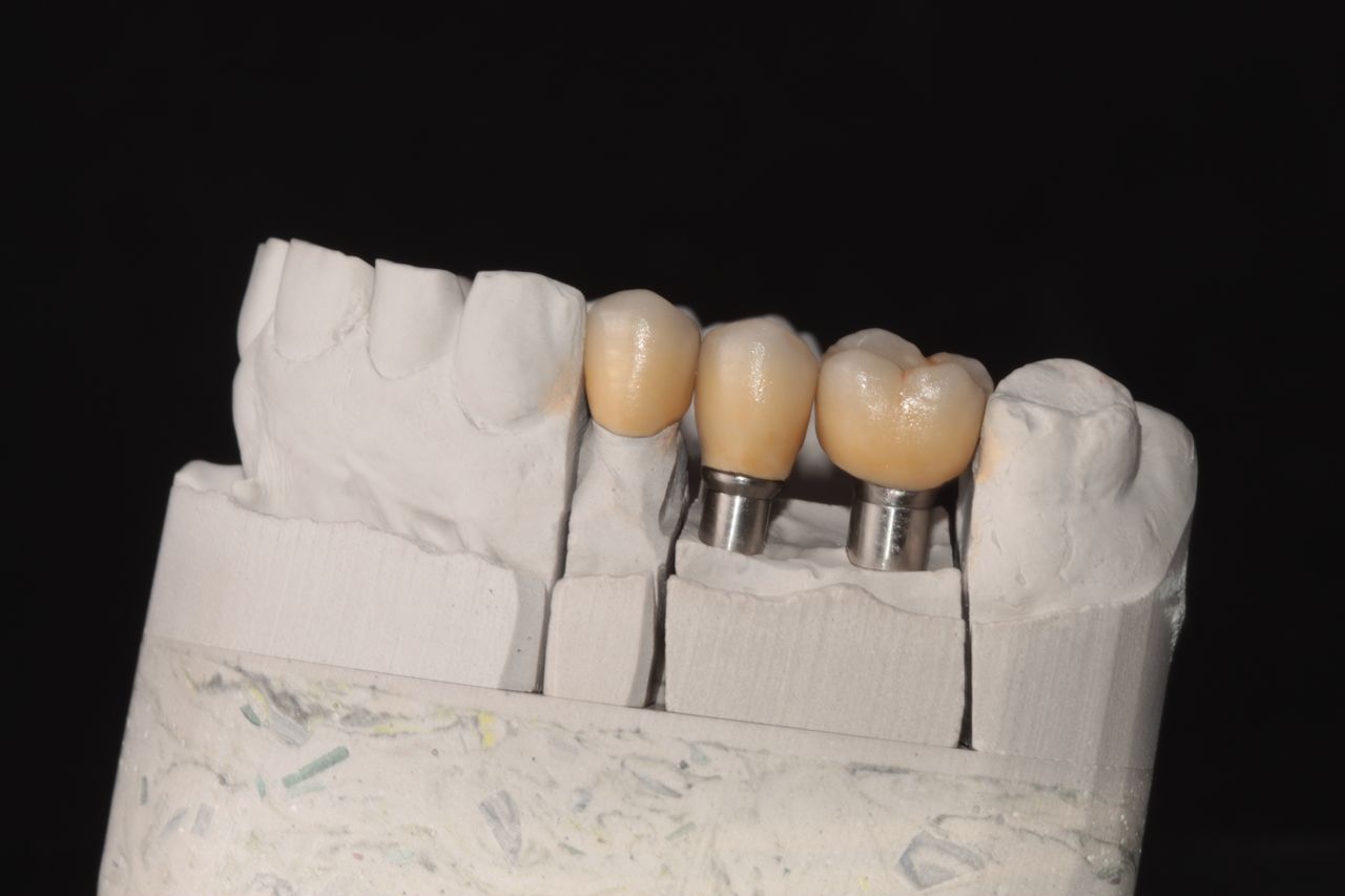 Aide Montserrat Orozco Gutierrez-34