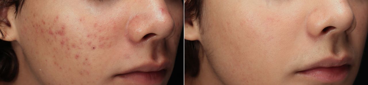 Lauro Francisco Varela Coronado-4