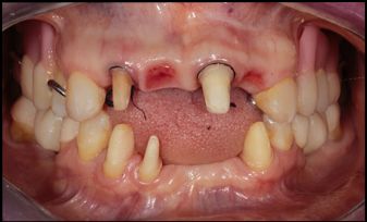 Mariel Itzayani Torres López-12