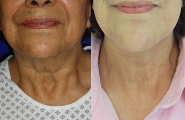 Carlos Gerardo Alfaro Moreno-23