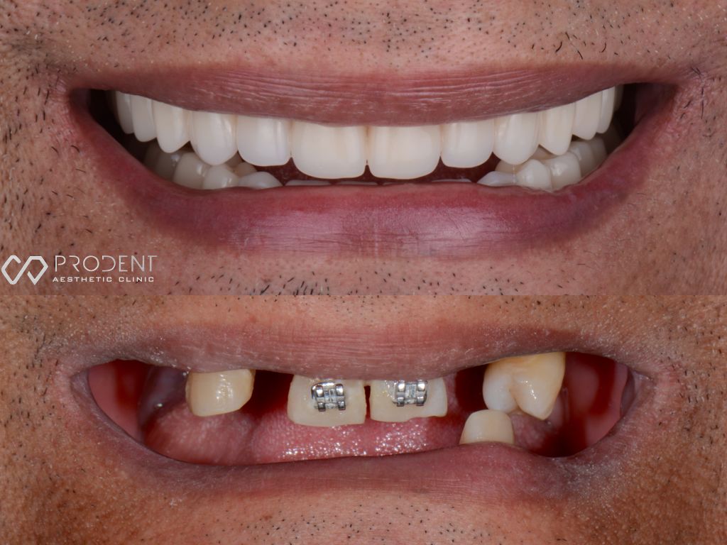 Ulises Pérez Murillo-86