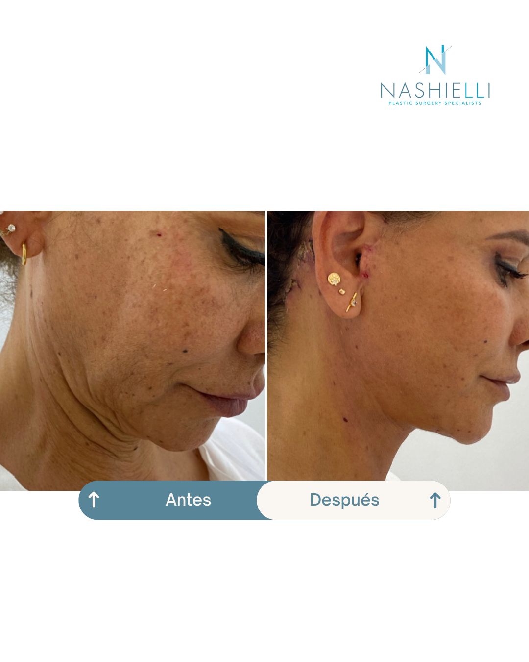 Nashielli Torres Espinosa Chiu-27